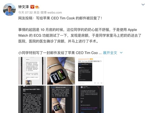 藏在智能表心电科技背后的温度：ECG并非冰冷数据